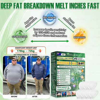 Official AUS Store 🇦🇺  | 🧑‍⚕️🩺 𝐆𝐞𝐞𝐋𝐞𝐦𝐨𝐧® Moringa · Berberine × NAD+ 𝟏𝟎-𝐢𝐧-𝟏 𝐀𝐝𝐯𝐚𝐧𝐜𝐞𝐝 𝐍𝐚𝐧𝐨 𝐌𝐢𝐜𝐫𝐨𝐧𝐞𝐞𝐝𝐥𝐞 𝐏𝐚𝐭𝐜𝐡 — 𝐎𝐧𝐜𝐞 𝐃𝐚𝐢𝐥𝐲, 𝐕𝐢𝐬𝐢𝐛𝐥𝐞 𝐑𝐞𝐬𝐮𝐥𝐭𝐬 𝐢𝐧 𝟕 𝐃𝐚𝐲𝐬