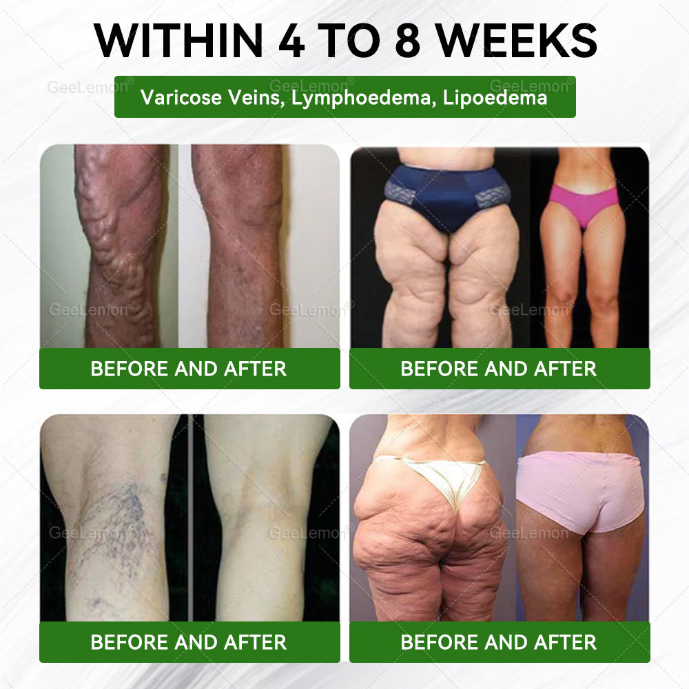 👉𝐆𝐞𝐞𝐋𝐞𝐦𝐨𝐧® 𝐌𝐨𝐫𝐢𝐧𝐠𝐚 · 𝐁𝐞𝐫𝐛𝐞𝐫𝐢𝐧𝐞 × 𝐍𝐀𝐃+ 𝟏𝟎-𝐢𝐧-𝟏 𝐀𝐝𝐯𝐚𝐧𝐜𝐞𝐝 𝐍𝐚𝐧𝐨 𝐌𝐢𝐜𝐫𝐨𝐧𝐞𝐞𝐝𝐥𝐞 𝐏𝐚𝐭𝐜𝐡 — 🇺(𝐉𝐮𝐬𝐭 𝐨𝐧𝐜𝐞 𝐚 𝐝𝐚𝐲, 𝐯𝐢𝐬𝐢𝐛𝐥𝐞 𝐜𝐡𝐚𝐧𝐠𝐞𝐬 𝐢𝐧 𝟕 𝐝𝐚𝐲𝐬）𝘽𝙚𝙧𝙗𝙚𝙧𝙞𝙣𝙚 + 𝙈𝙤𝙧𝙞𝙣𝙜𝙖 𝙁𝙤𝙧𝙢𝙪𝙡𝙖 ✅ 𝐅𝐨𝐫 𝐨𝐛𝐞𝐬𝐢𝐭𝐲, 𝗟𝗼𝗼𝘀𝗲 𝘀𝗸𝗶𝗻,𝐝𝐢𝐚𝐛𝐞𝐭𝐞𝐬, 𝐬𝐥𝐞𝐞𝐩 𝐚𝐩𝐧𝐞𝐚, 𝐣𝐨𝐢𝐧𝐭 𝐢𝐬𝐬𝐮𝐞𝐬, 𝐚𝐧𝐝 𝐦𝐨𝐫𝐞 💥